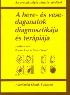 Mark Goepel  (Szerk.) - Dr. Romics Imre  (Szerk.) - A here- s vesedaganatok diagnosztikja s terpija
