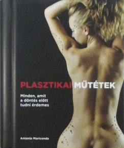 Antonia Mariconda - Plasztikai mttek
