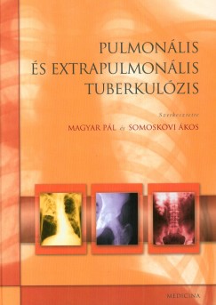 Magyar Pl  (Szerk.) - Somoskvi kos  (Szerk.) - Pulmonlis s extrapulmonlis tuberkolzis