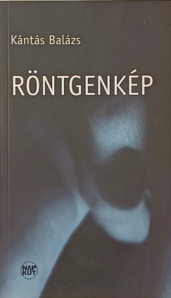Knts Balzs - Rntgenkp