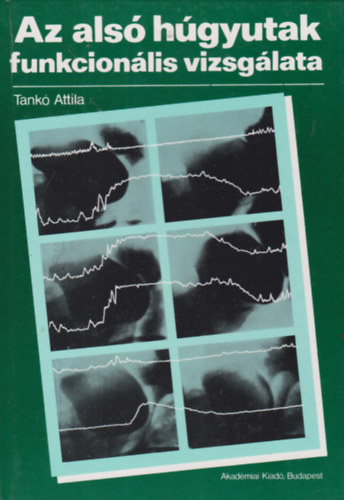 Tankó Attila - Az alsó húgyutak funkcionális vizsgálata