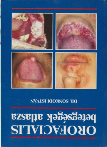 Dr. Sonkodi Istv�n - Orofacialis betegs�gek atlasza