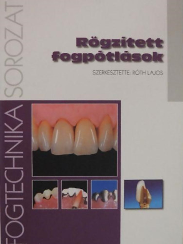 Róth Lajos (szerk.) - Rögzített fogpótlások