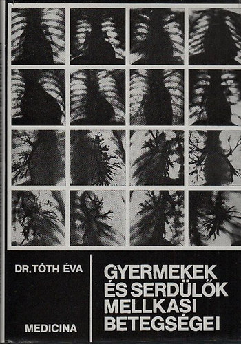 Dr. Tóth Éva - Gyermekek és serdülők mellkasi betegségei