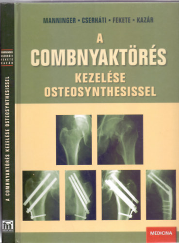 Szerkesztette: Manninger Jenő - Cserháti Péter - Fekete Károly - Kazár György - A combnyaktörés kezelése osteosynthesissel (Dedikált)