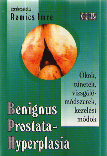 Romics Imre (szerk.) - Benignus prostatahyperplasia