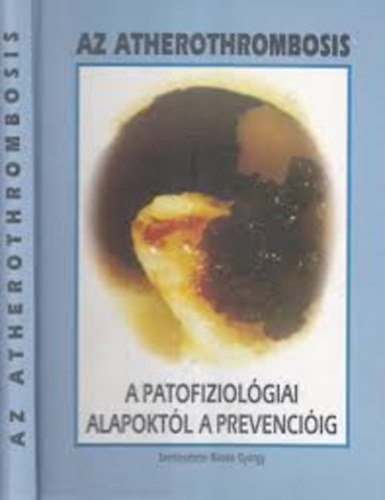 Dr. Blask� Gy�rgy - Az atherothrombosis a patofiziol�giai alapokt�l a prevenci�ig