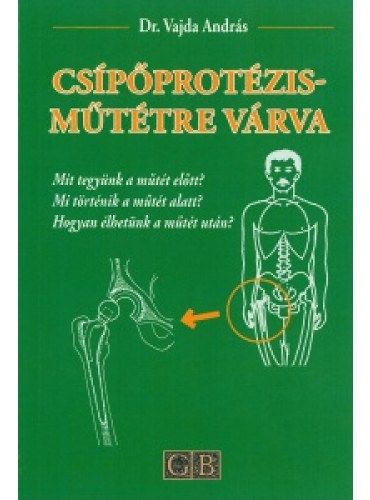 Dr. Vajda Andrs - Cspprotzis-mttre vrva