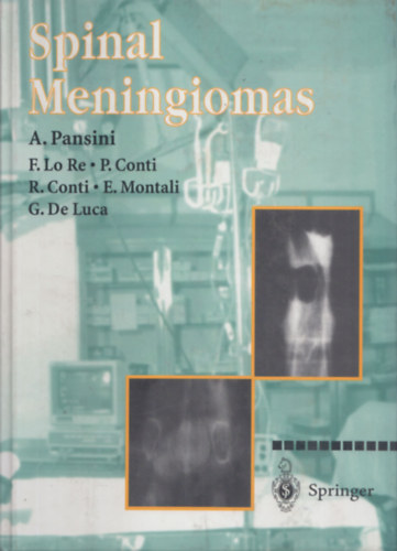 A. Pansini, F. Lo Re, P. Conti, R. Conti, E. Montali, G. De Luca - Spinal meningiomas