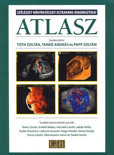 Dr. Papp Zoltn \(szerk.), Tank Andrs, Dr. Tth Zoltn - Szlszet-ngygyszati ultrahang-diagnosztikai ATLASZ