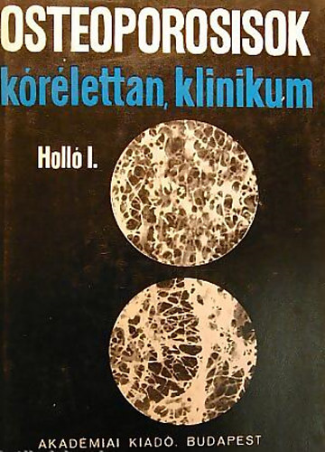 Dr. Holló István - Osteoporosisok - Kórélettan, klinikum
