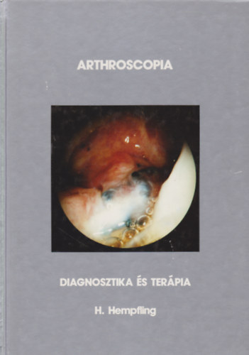 H. Hempfling - Arthroscopia - Diagnosztika �s ter�pia