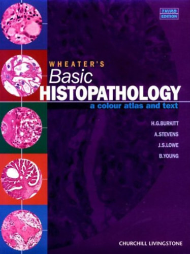H.G. Burkitt, A. Stevens, J.S. Lowe, B.Young - Wheater's Basic Histopathology: A Colour Atlas and Text (Third Edition)