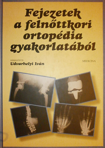 Udvarhelyi Iván - Fejezetek a felnőttkori ortopédia gyakorlatából