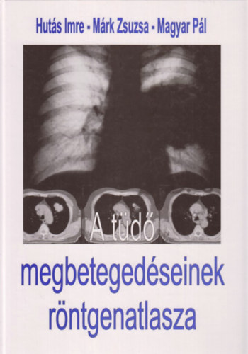Huts, Mrk, Magyar Pl - A td megbetegedseinek rntgenatlasza