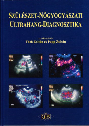 Tth Zoltn (szerk.), Papp Zoltn (szerk.) - Szlszet-ngygyszat ultrahang-diagnosztika