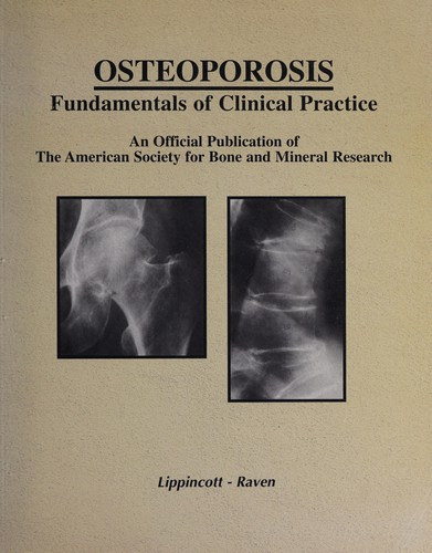 Murray J. Favus (szerk.) - Osteoporosis - Fundamentals of Clinical Practice