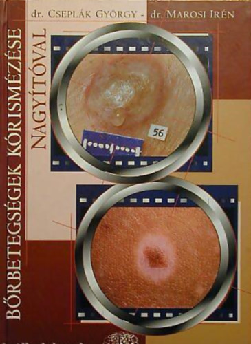 Dr. Marosi Ir�n, Csepl�k Gy�rgy - B�rbetegs�gek k�rism�z�se nagy�t�val