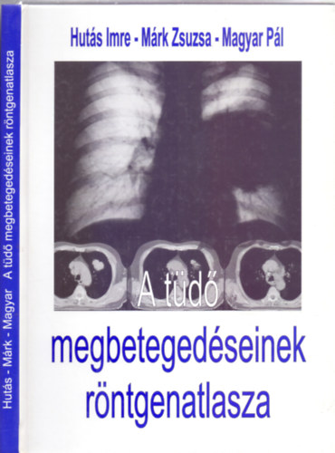 Huts Imre - Mrk Zsuzsa - Magyar Pl, Fszerkeszt: Forgcs Sndor dr. - A td megbetegedseinek rntgenatlasza (Novartis)