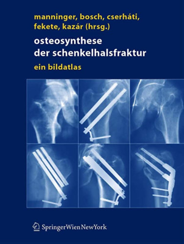 Manninger Jen, Ulrich Bosch, Cserhti Pter, Fekete Kroly, Gyrgy Kazr - Osteosynthese der schenkelhalsfraktur