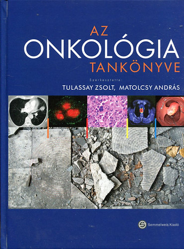 Tulassay Zsolt - Matolcsy András szerk - Az onkológia tankönyve