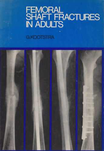 Gauke Kootstra - Femoral Shaft Fractures in Adults