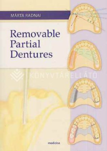Radnai Márta - Removable partial dentures