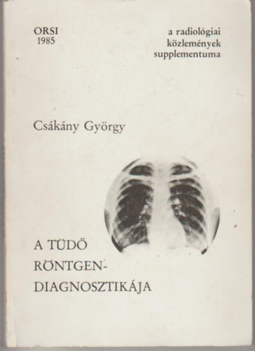 Cs�k�ny Gy�rgy - A t�d� r�ntgendiagnosztik�ja.