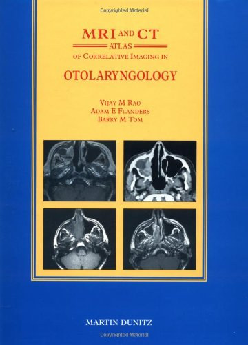 Vijay M. Rao, Adam E. Flanders, Barry M. Tom - MRI and CT Atlas of Correlative Imaging in Otolaryngology
