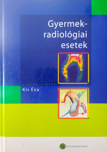 Dr. (szerk.) Kis �va - Gyermek-radiol�giai esetek