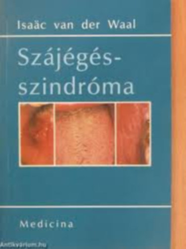 Isaac Van Der Waal - Sz�j�g�s sz�ndr�ma