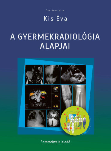 Kis �va - A gyermekradiol�gia alapjai