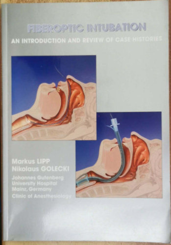 Nikolaus LIPP, Markus & GOLECKI - Fiberoptic intubation: an introduction and review of case histories