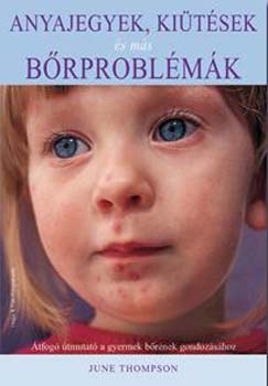 Thomson, June - Anyajegyek, kiütések és más bőrproblémák