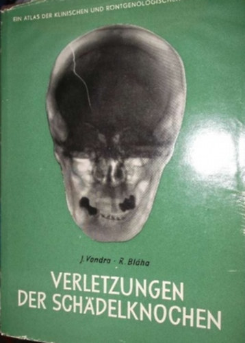 J. Vondra, R. Bláha - Verletzungen der Schädelknochen