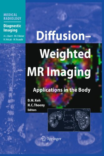 Dow-Mu Koh, MD, Harriet C. Thoeny, MD, A. L. Baert, M. F. Reister, Hedvig Hricak, MD, PhD, Michael Knauth - Diffusion-Weighted MR Imaging Applications in the Body (Medical Radiology Diagnostic Imaging)