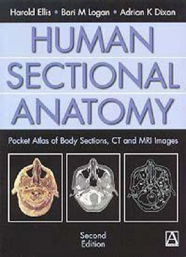 Prof. Harold Ellis - Human Sectional Anatomy: Pocket Atlas of Body Sections, CT and MRI Images