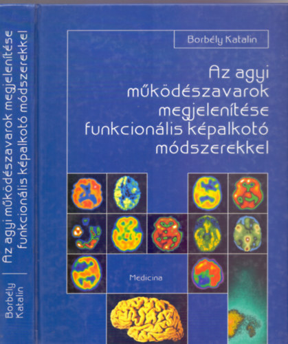 Dr. Borbly Katalin, Lektorlta: Prof. Dr. Szirmai Imre - Az agyi mkdszavarok megjelentse funkcionlis kpalkot mdszerekkel (Sznes s fekete-fehr brkkal)