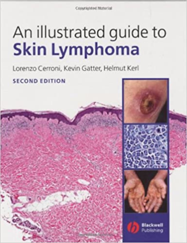 Lorenzo Cerroni, Kevin Gatter, Helmut Kerl - An Illustrated Guide To Skin Lymphoma