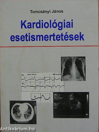 Tomcsányi János - Kardiológiai esetismertetések