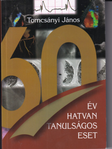 Tomcsnyi Jnos - 60 v hatvan tanulsgos eset