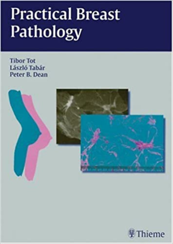 Tibor Tot, L�szl� Tab�r, Peter B. Dean - Practical Breast Pathology