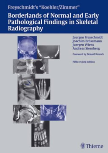 Juergen Freyschmidt, Joachim Brossmann, Juergen Wiens, Andreas Sternberg, Donald Resnick MD - Koehler/Zimmer's Borderlands of Normal and Early Pathological Findings in Skeletal Radiography