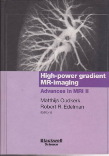 Matthijs Oudkerk, Robert R. Edelman - High-power Gradient MR Imaging: Advances in MRI II