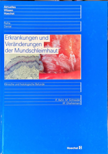 R. Rahn, M. Schneider, M. Ghahremani - Erkrankungen und Veränderungen der Mundschleimhaut