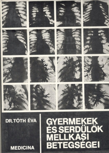 Dr. Tóth Éva - Gyermekek és serdülők mellkasi betegségei