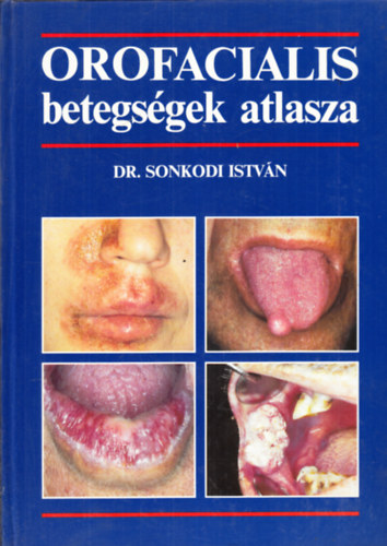 Dr. Sonkodi Istv�n - Orofacialis betegs�gek atlasza