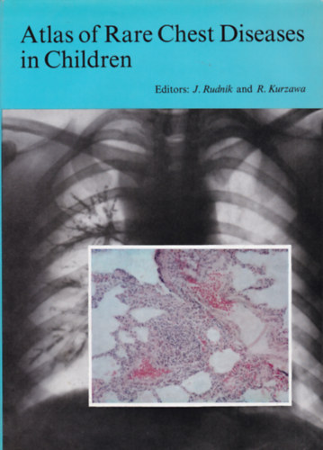 Rudnik - Kurzawa - Atlas of Rare Chest Diseases in Children (Ritka gyermek-tüdőmegbetegedések atlasza - angol nyelvű)