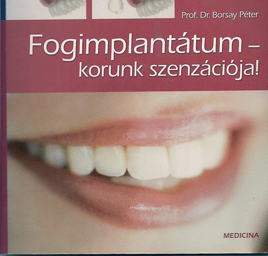 Prof. Dr. Borsay Péter - Fogimplantátum-korunk szenzációja!