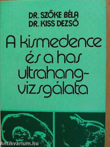 Kiss Dezs� dr. Sz�ke B�la dr. - A kismedence �s a has ultrahangvizsg�lata